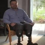 iki bacagini da kesti olayin asil sebebi duyanlari hayrete dusurdu L4F4rRKL